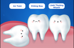 Nhổ Răng Khôn Có Nguy Hiểm Không? Những Lưu Ý Cần Nắm